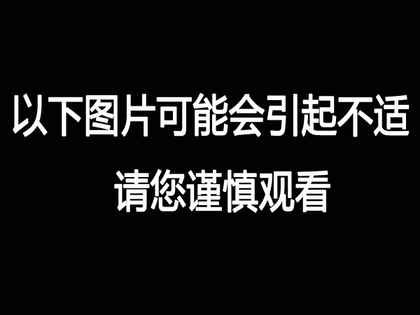 上海热线健康频道-- 奇幻!医学<em>3d</em>透视下的人体